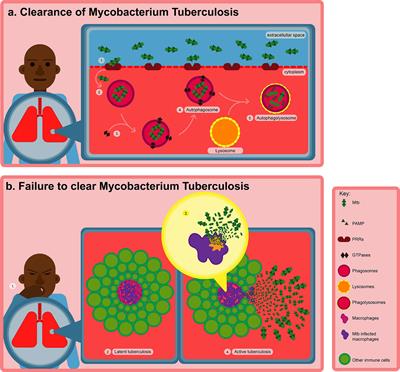 The Macrophage Response to Mycobacterium tuberculosis and Opportunities for Autophagy Inducing Nanomedicines for Tuberculosis Therapy